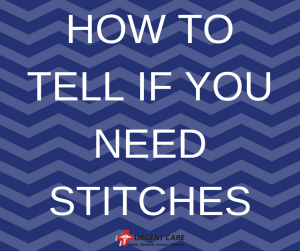 "How to tell if you need stitches" text against blue background