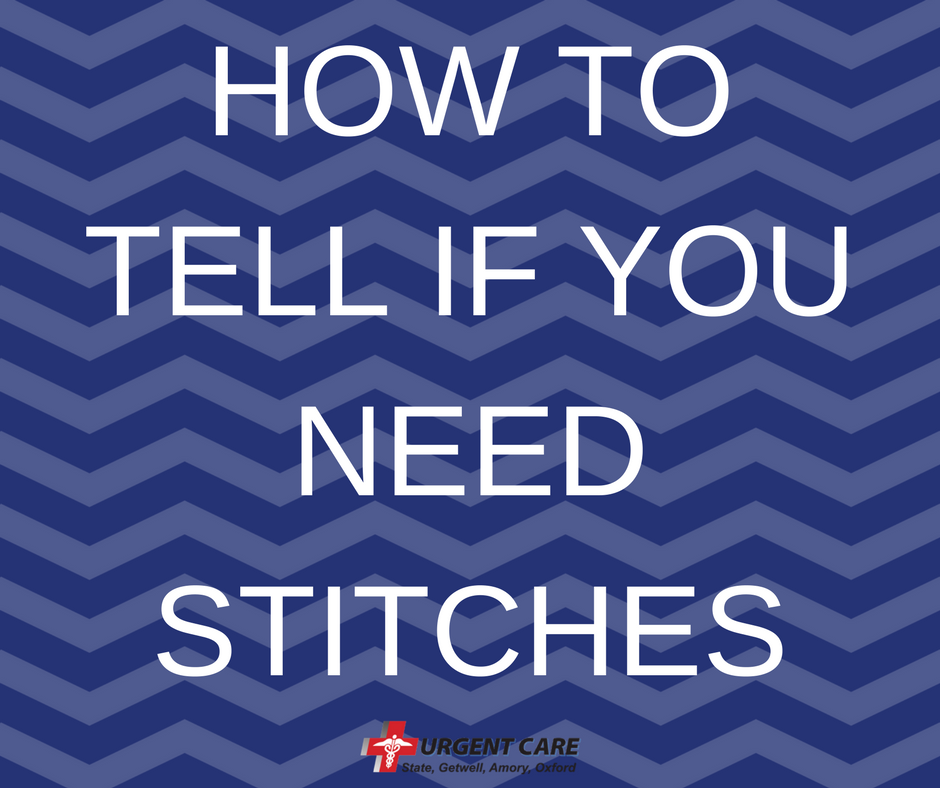 "How to tell if you need stitches" text against blue background